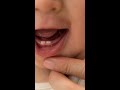 Signs of teething in babies