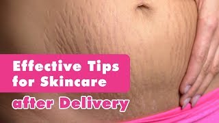 Effective Skincare Tips After Delivery