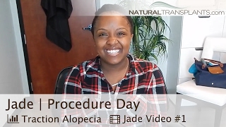 Female Hair Loss Solutions | Hair Transplants for Thinning Edges (Jade)