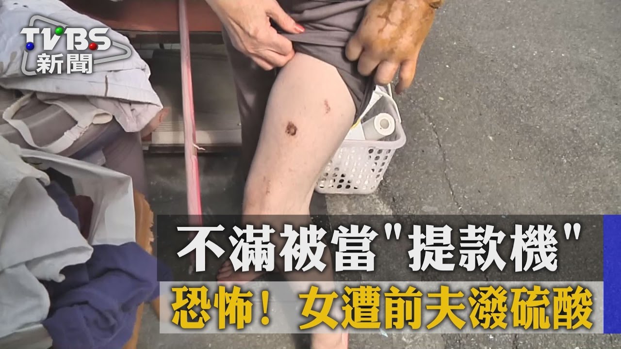 恐怖!不滿被當「提款機」女遭前夫潑硫酸
