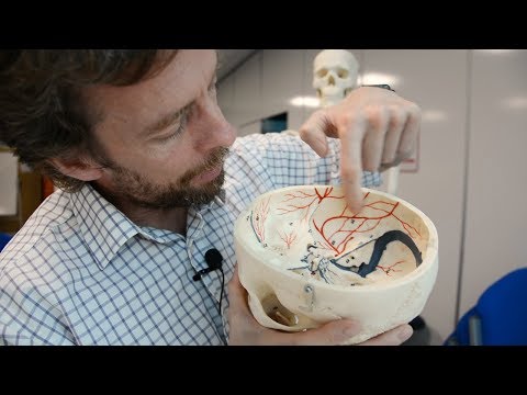 Middle meningeal artery (& extradural haematoma, or why a blow to the side of the head can kill)