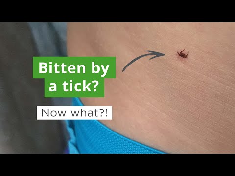 How to Remove a Tick | What To Do if You Get Bitten by a Tick