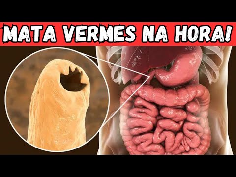 5 BEST FOODS IN THE WORLD TO KILL WORMS AND PARASITES | HOME REMEDY FOR WORMS