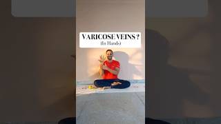 VARICOSE VEINS? Fix it with these exercises. #yoga #fitness #stretching #selfcare #hand