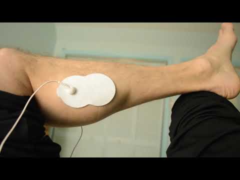 Achilles Rupture Surgery Recovery-  TENS unit response