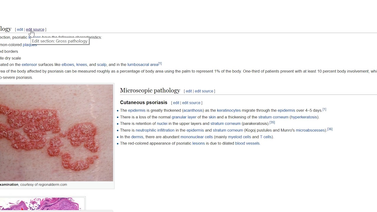 How to fix heading/image misalignment