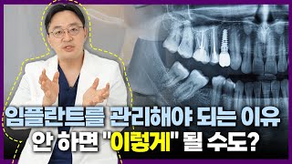 임플란트의 관리가 필요한 이유는 