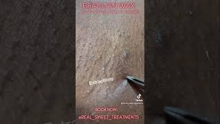 Download lagu Brazilian Wax with HydroJelly treatment. #brazilianwax #getwaxed #waxing mp3 Download lagu Brazilian Wax with HydroJelly treatment. #brazilianwax #getwaxed #waxing mp3
