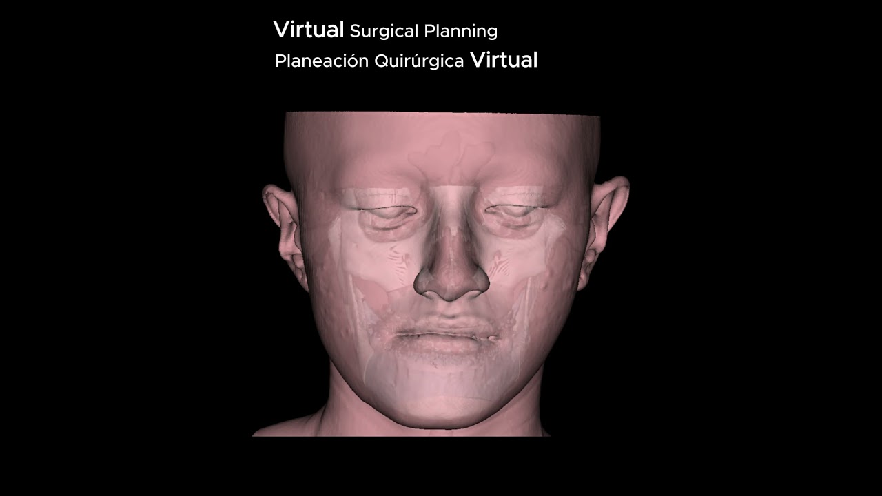 Miguel Ángel Moreno Alba-7