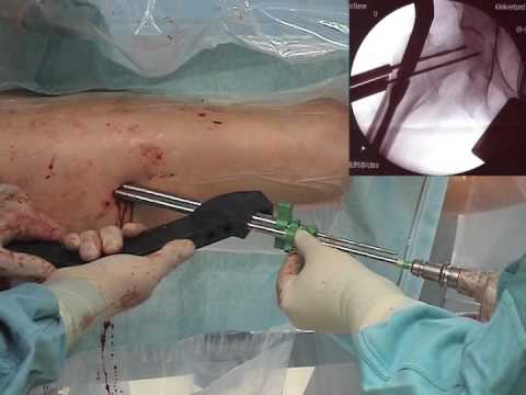 Wenn schwindlig mit Osteochondrose Rückenschmerzen in der Nacht rechts oberhalb der Taille