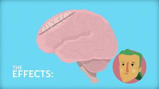 Cannabis and the Endocannabinoid System