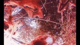 Ataraxia   Fountains