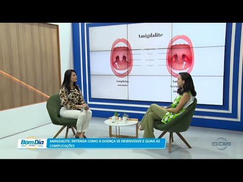 Amigdalite: Entenda como a doença se desenvolve e quais as complicações 29 12 2022