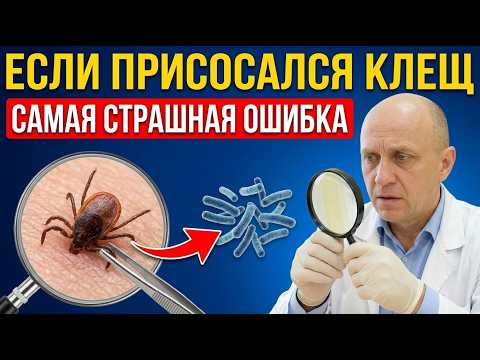 НИКОГДА не тяните КЛЕЩА пинцетом! 3 шага, которые спасут от болезни Лайма (бореллиоз)