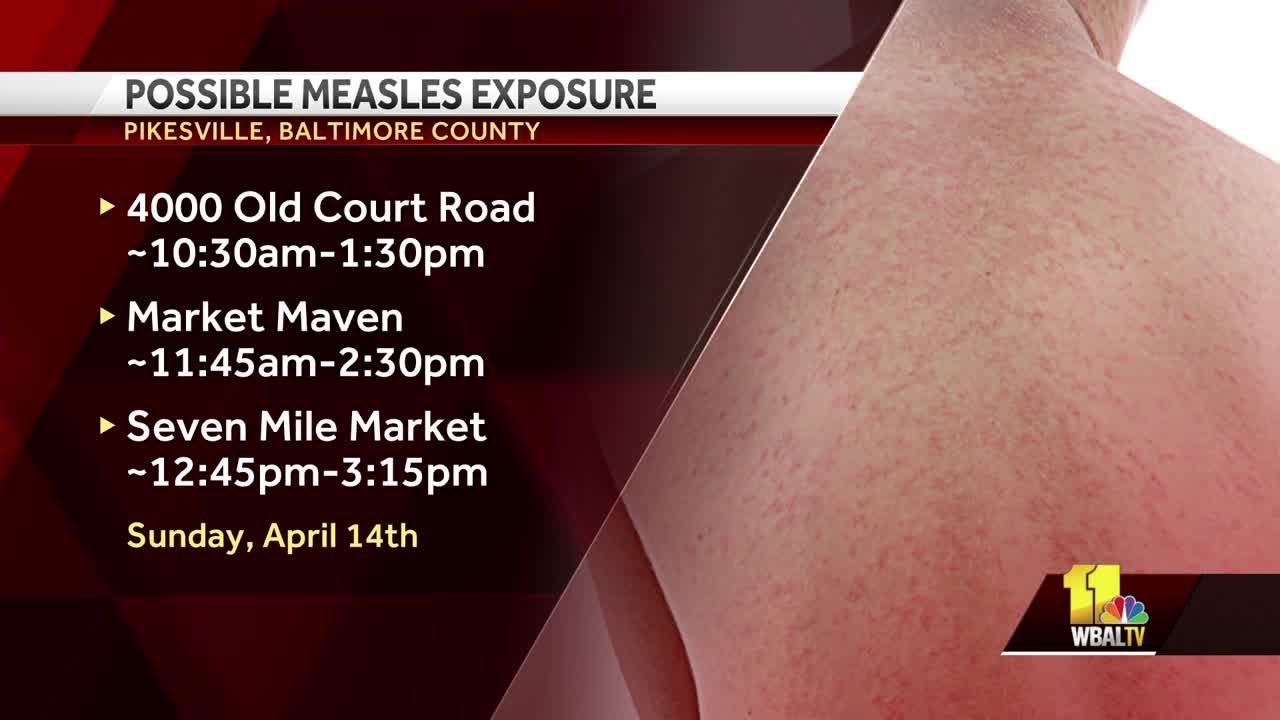 Third case of measles confirmed in Maryland resident