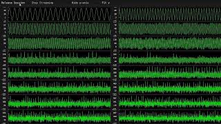 Rust egui brainflow 5 EEG eframe
