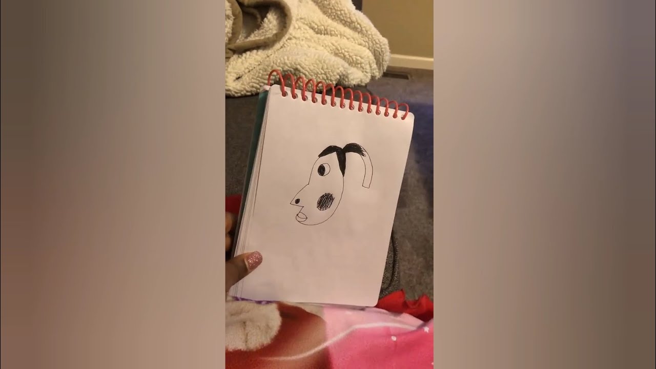 Hyperpigmentation meme