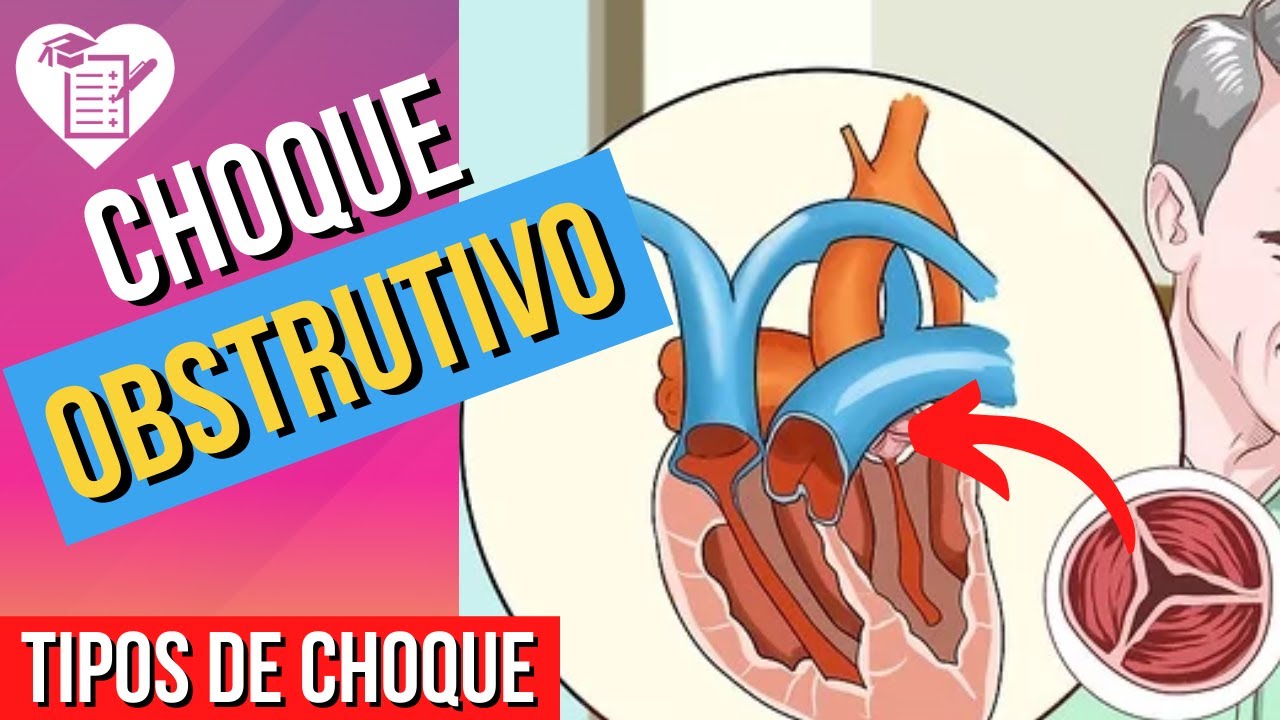 CHOQUE OBSTRUTIVO - Causas, Sintomas e Tratamento