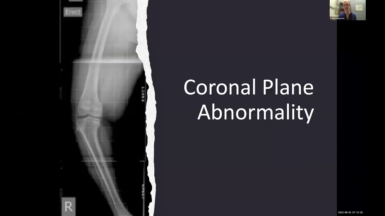 Session 01: Lower Limb Differences in Children
