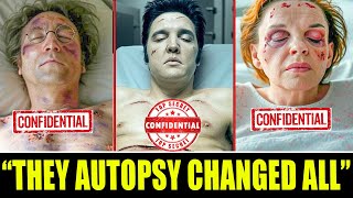10 Shocking Autopsy Revelations From Singer Legends’ Deaths
