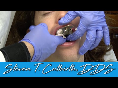 Dental Assisting - How to Take Alginate Impressions