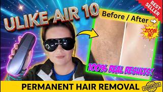 Stop Shaving! At Home IPL Hair Removal ULike AIR 10 Review NOT SPONSORED
