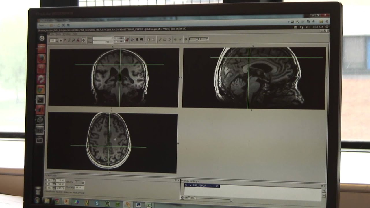 Translational Neuroimaging MSc