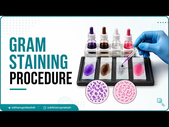 Vídeo relacionado con A Laboratory Course in Serum Study: Bacteriology 208, Being a Series of Experiments and Diagnostic Tests in Immunology Carried Out in an Optional ... of Bacteriology, College of Physicians and Su