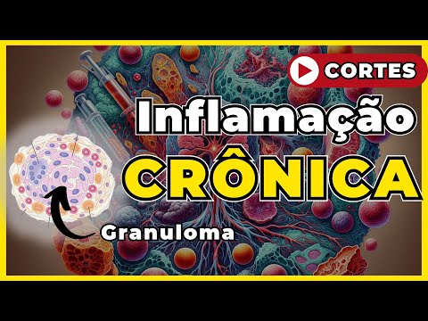 Inflamação Crônica [ Patologia Geral ]