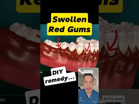 Red, Sore Gums? Fix Them in 3 Easy Steps! #dentallan #dentist #shorts