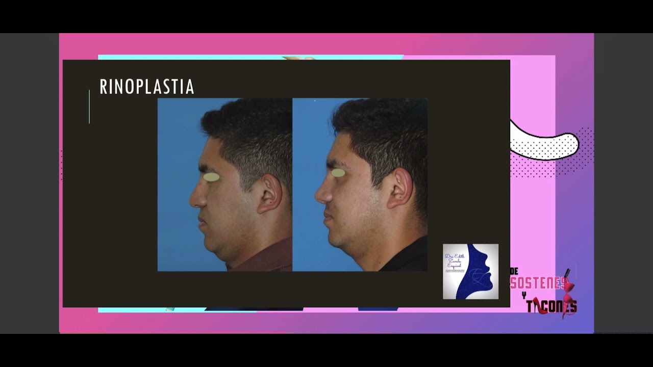 Emma Edith Zavala Esquivel-31