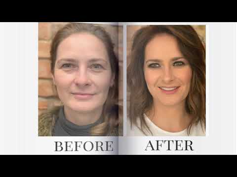 METAMORFOZA Ewelina 2018