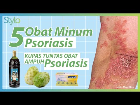 , title : '5 Obat Minum Psoriasis Terbaik, Cara Ampuh Mengatasi Penyakit Kulit Autoimun Psoriasis | Stylo.ID'