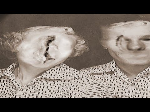 SCP-715  |  My Face That I May Be  |  Safe  |  Observational SCP