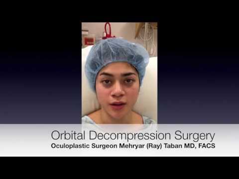 Orbital Decompression Surgery Orbital Decompression Surgery