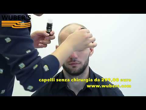 Cura di psoriasi di un imupsor di tazze di imupsora charak risposte Malattia di eczema di che