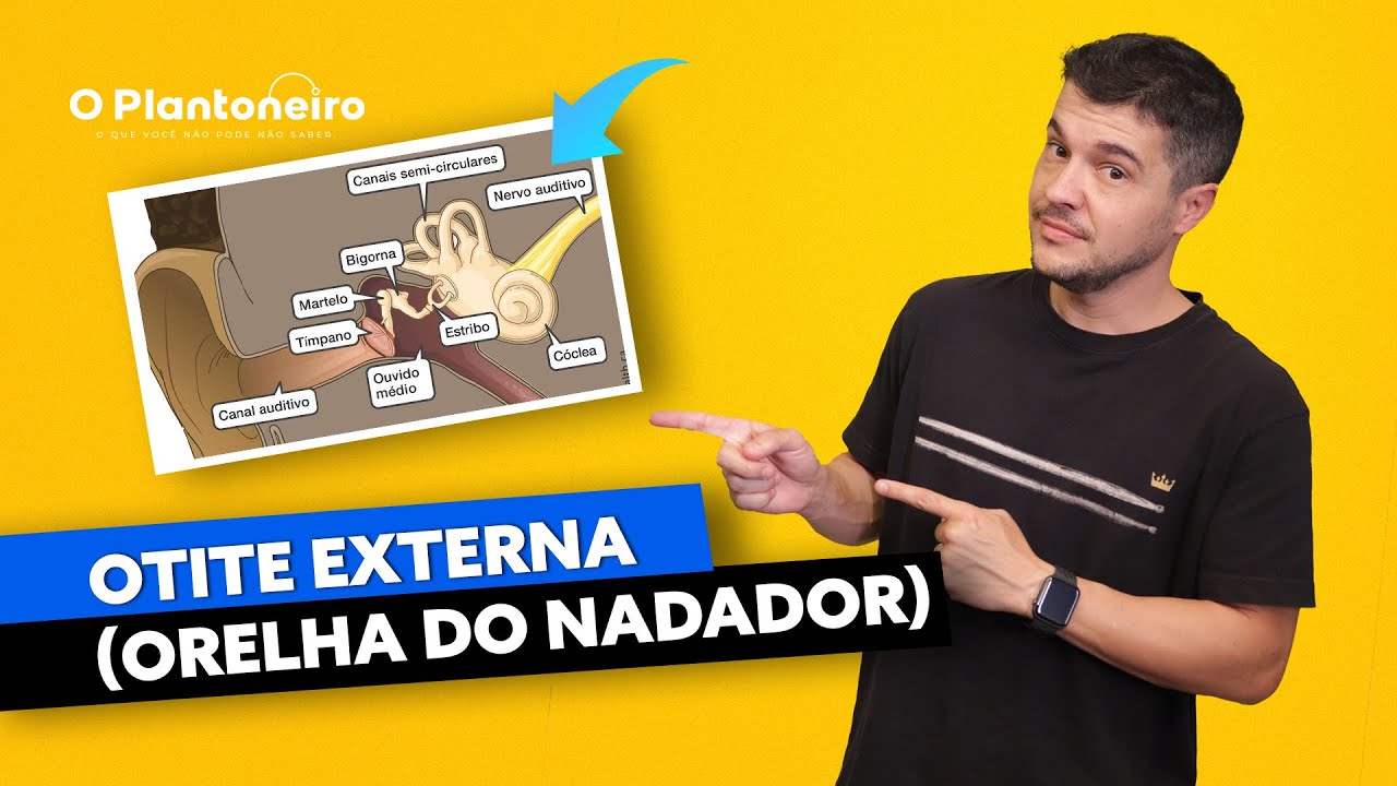 Otite Externa (Orelha do Nadador)