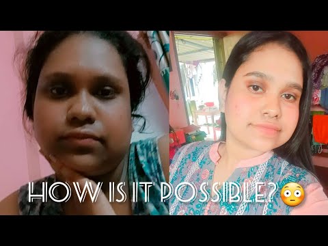 My realistic daily basis skincare routine|PCOD|Hyperpigmentation|Seborrheic dermatitis|Dark Circles|