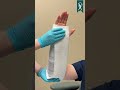 Watch a sugar tong splint casting! #armcast #healthcareprofessionals #healthcaretips