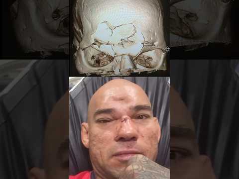 MVP vs Cyborg Santos - Career-Changing Moment #cyborg #mma #michaelvenompage