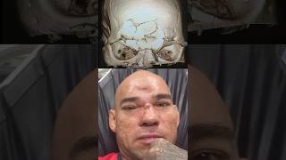 MVP vs Cyborg Santos - Career-Changing Moment #cyborg #mma #michaelvenompage