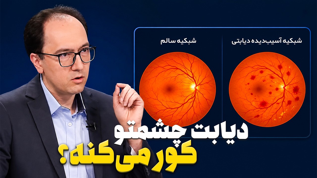 علائم خطرناک دیابت چشم و بهترین زمان معاینه شبکیه