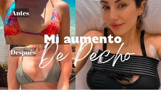 Mi intervención de pecho en Madrid. Clínica NAAC con el Doctor Gustavo Barragán.