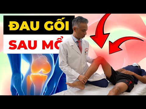 ÁM ẢNH GỐI MỔ 2 THÁNG KHÔNG KHỎi - Sai lầm Chết người 90% Bệnh nhân Mắc phải