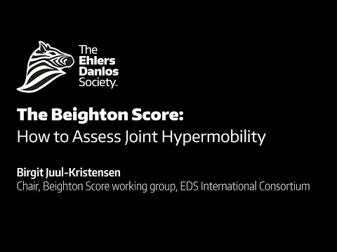 The Beighton Scoring System