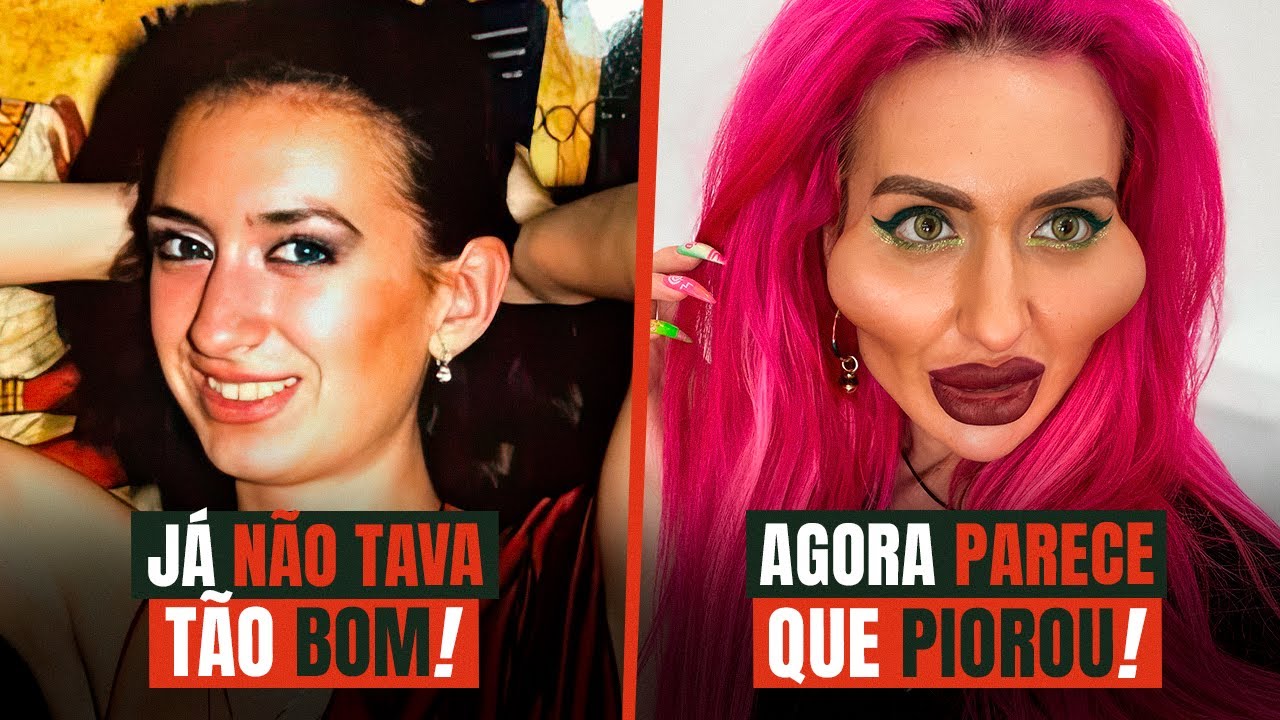 FORAM LONGE DEMAIS NA HARMONIZAÇÃO FACIAL