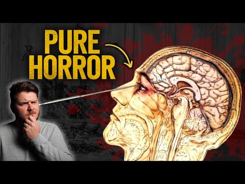 The Lobotomy Was SO Much Worse Than You Think