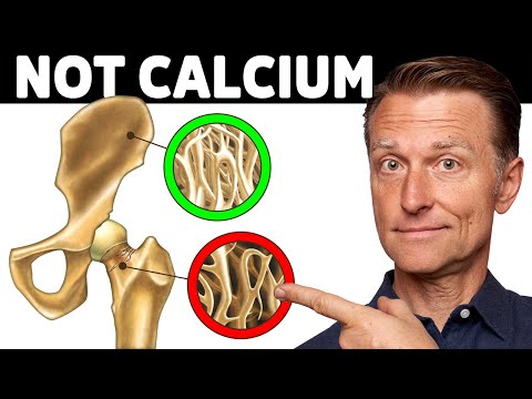 骨質疏鬆症不是鈣的問題 (Osteoporosis Is NOT a Calcium Problem)