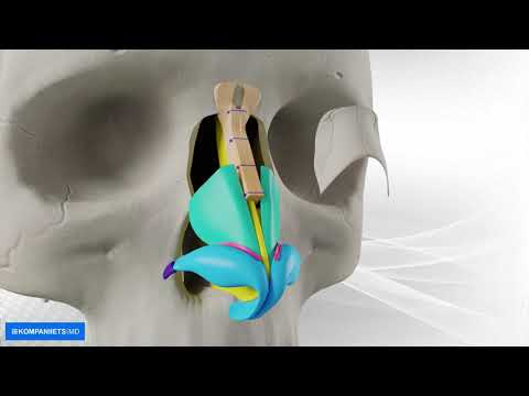 Фото 3D-анимация операции на носе.