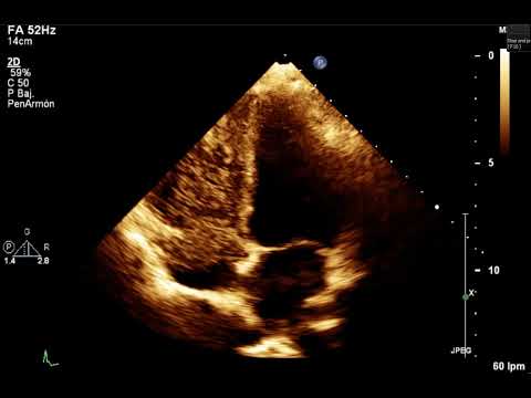Heriberto Pruneda Ayala-24